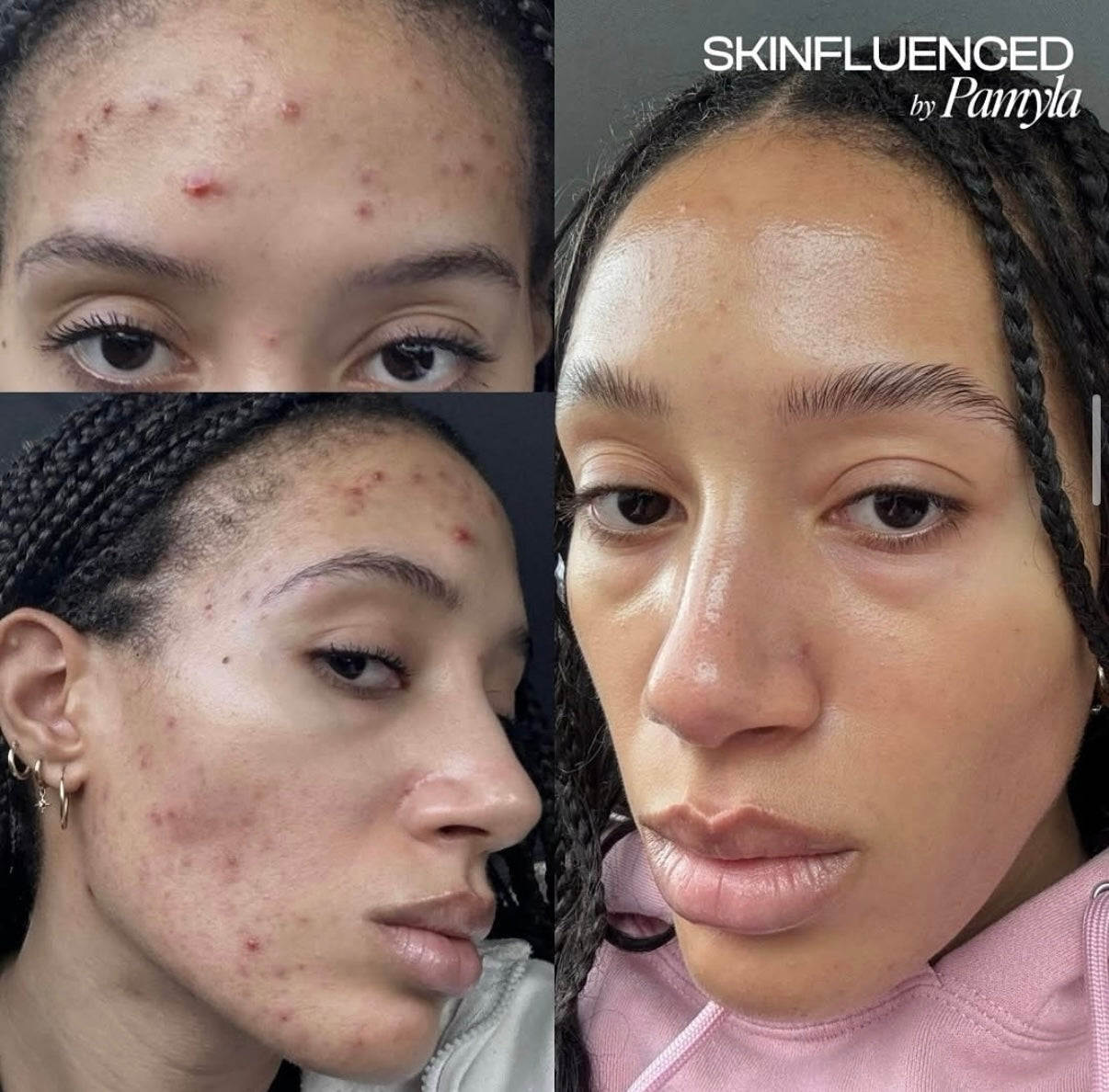 Koreaanse green sea peeling